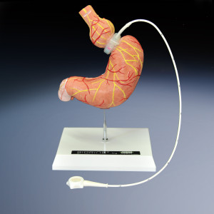 estomac bioring